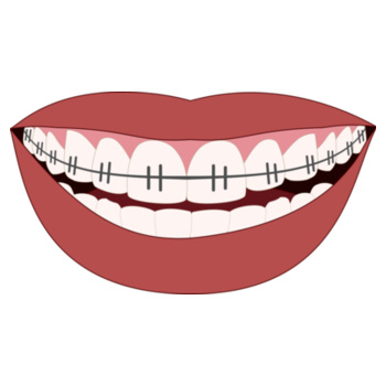 Perfect Smile Mask Design