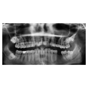 X-Ray Mouth Mask Design